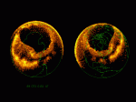 Large aurora created by a CME in 1989 (Credits: NASA).