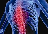 The ISS Spinal Ultrasound Investigation studies the impact of astronauts' spinal elongation (Credits: iStockphoto/S. Kaulitzki).
