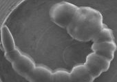 Mosquito larva wiggles in a scanning electron microscope vacuum (Credits: Yasuharu Takaku et al).