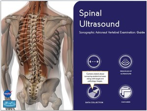 The Spinal Ultrasound training tool that launch in the fall of 2012 (Credits: NASA/Scott A. Dulchavsky).