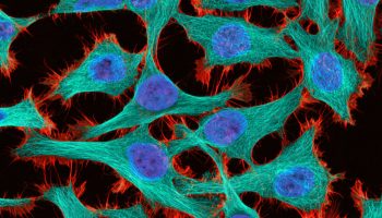 This 2-photon fluorescence 300x image of HeLa cancer cells won 12th place at the Nikon Small World 2011 competition. - Credits: Thomas Deerinck and Mark Ellisman, NCMIR, UCSD