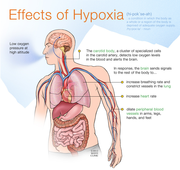 Effects of Hypoxia Courtesy of the Mayo Clinic